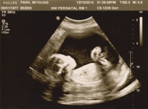 ultrasound 2014-12-10 14.jpg